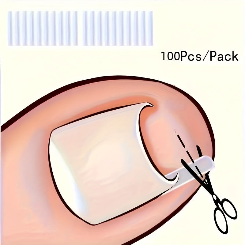 ingrown toenail 20 30 50 70 80 90 100pcs