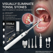 tonsil stone remover camera 1080p hd visual removal