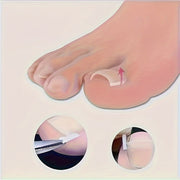 ingrown toenail   20 30   50   70 80 90 100pcs